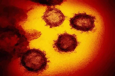 Coronavirus (COVID-19) Real image from Electron Microscope Stock Illustration