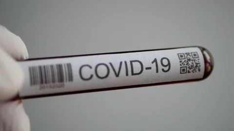 Coronavirus (covid-19) SARS test tube with blood sample moving in medical glove Stock Footage 126514721