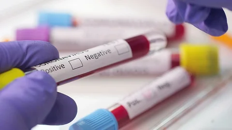 Coronavirus COVID-19 Test Stock Footage 128112574
