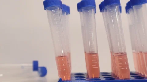 Coronavirus COVID-19 Testing Swabs in Pink Serum to find Positive Negative 스톡 동영상 127794448