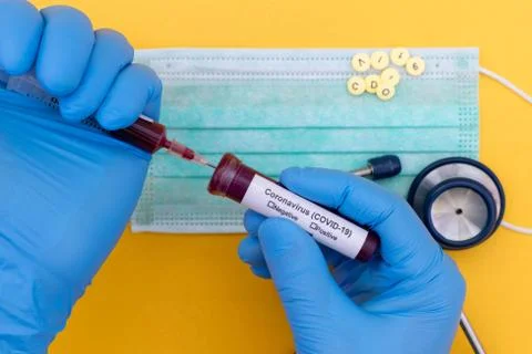 Coronavirus (COVID-19) testng concept, Hand holds a test tube containing a bl 写真素材