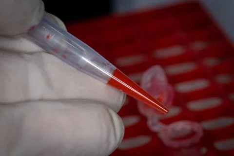 Coronavirus field test sample Stock Photos