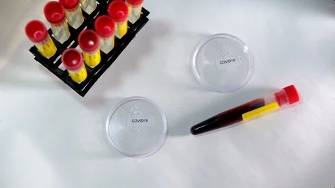 Coronavirus 스톡 동영상 126404521