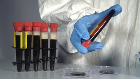 Coronavirus 스톡 동영상 126506146