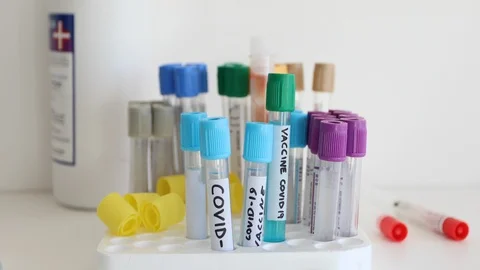 Coronavirus laboratory test tubes looking for a vaccine Stock-Footage 125404087