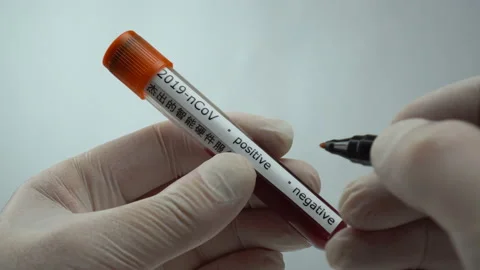 Coronavirus negative test tube blood in laboratory. 2019-nCoV, Covid 19 Stock Footage