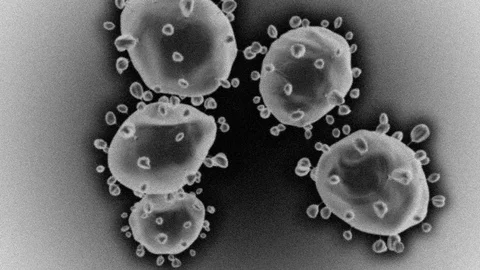 Coronavirus like Scanning electron microscope Gray Stock Footage 123471889