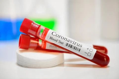 Coronavirus test and laboratory sample of blood Stock Photos