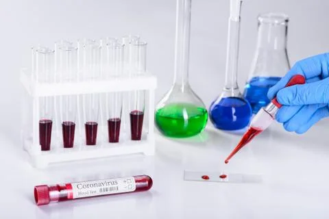 Coronavirus test and laboratory sample of blood Stock Photos