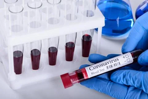 Coronavirus test and laboratory sample of blood Stock Photos