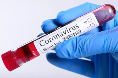 Coronavirus test and laboratory sample of blood isolated on white Stock Photos