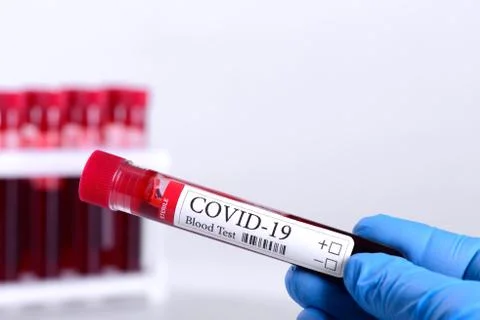 Coronavirus test and laboratory sample of blood isolated on white Stock Photos