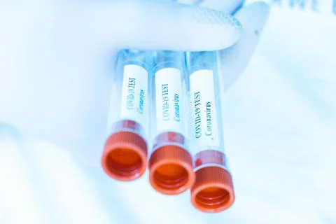 Coronavirus test concept Stock Photos
