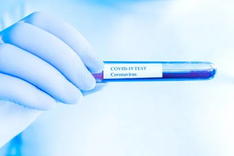 Coronavirus test concept Stock Photos