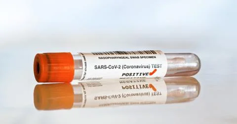 Coronavirus test concept - vial sample tube with cotton swab, red mark next t Stock Photos