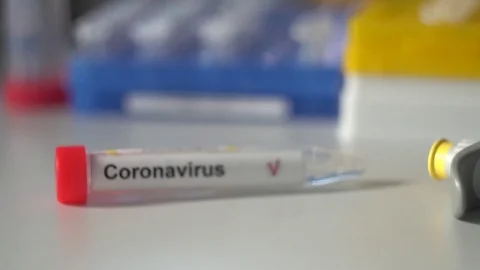 Coronavirus test. COVID-19 test or SARS-CoV-2 test. Video stock 127785970