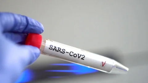 Coronavirus test. COVID-19 test or SARS-CoV-2 test. Stop spreading Video stock 127786278