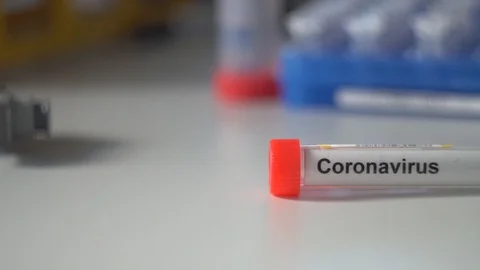 Coronavirus test. COVID-19 test or SARS-CoV-2 test. Stop spreading Stock-Footage 127787201