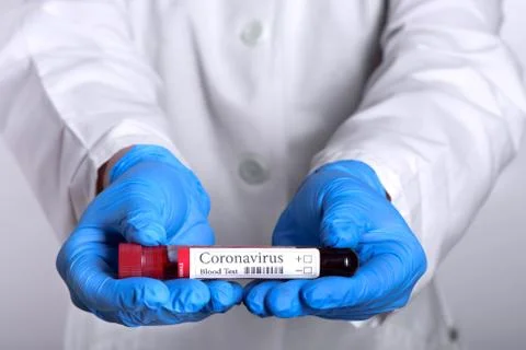 Coronavirus test  laboratory sample of blood and  laboratory assistant Stock Photos