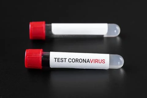 Coronavirus test text on a vacuum tube with a blood test and a second tube wi Stock Photos