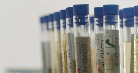 Coronavirus testing during outbreak 2020 Stock Footage 127651533