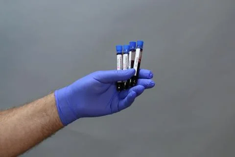 Coronavirus testing - a hand holds test tubes containing patient blood sample Stock Photos