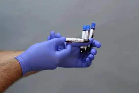 Coronavirus testing - a hand holds test tubes containing patient blood sample Stock Photos