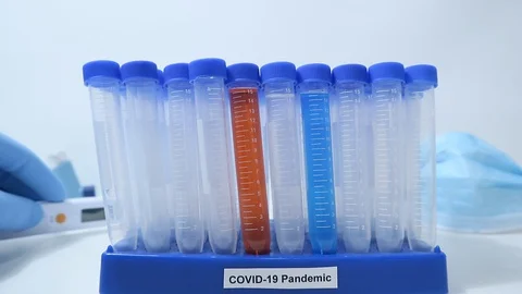 Coronavirus USA Testing on Front Lines Tungsten Lighting Thermometer 動画素材 128155682