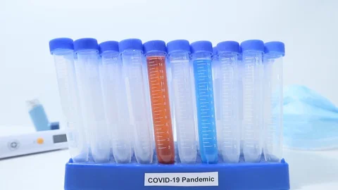 Coronavirus USA Testing on Front Lines Tungsten Lighting Zoom Motion Vídeo Stock 128155692