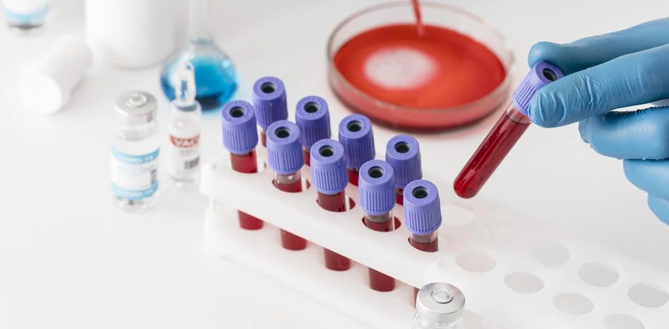 Coronavirus vaccine lab with samples Stock Photos