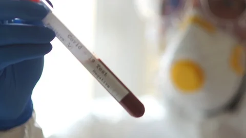 Coronovirus outbreak. Doctor's hands holding a test tube with a blood sample for Stock Footage 128779868