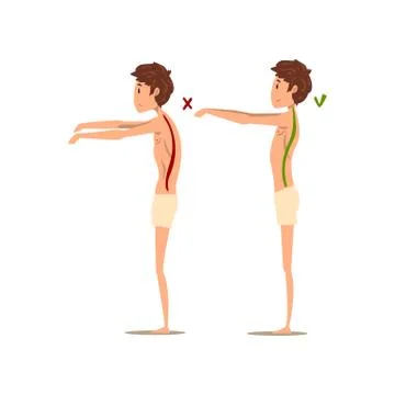Correct and wrong spine posture, side view vector Illustration on a white Ilustración de archivo