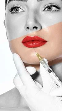 Correct form of woman's lips. Procedure lip augmentation Photos