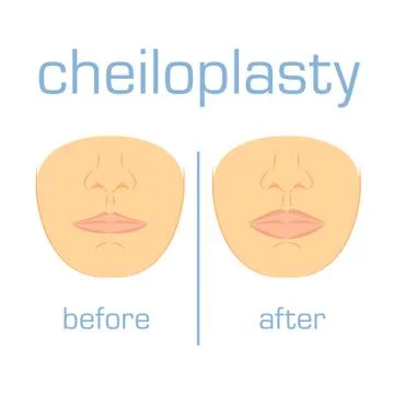 Correction form size lip white back Stock Illustration