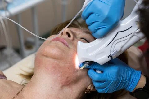 Correction of the second chin by injections of carbon dioxide by a cosmetologist Stock Photos
