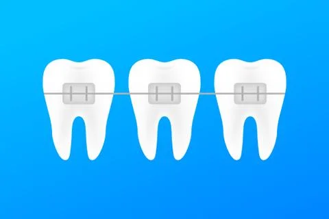 Correction of teeth with orthodontic braces. Stages of teeth alignment. Denta Stock Illustration