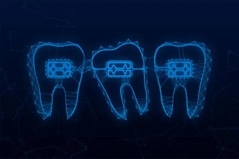 Correction of teeth with orthodontic braces. Stages of teeth alignment. Dental Stock Illustration