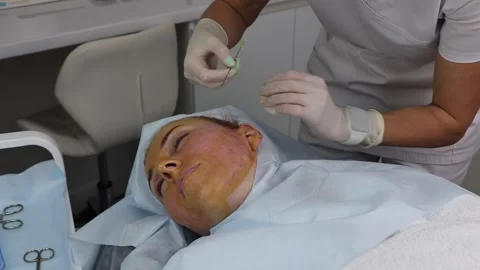 Correction of thread lifting of the face with absorbable threads. Close-up. Stock Footage 200988336