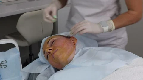 Correction of thread lifting of the face with absorbable threads. Close-up. Stock Footage 201093027