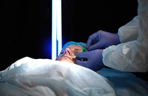 Correction of the volume and shape of the lips with mesothreads. Doctor plastic Foto stock