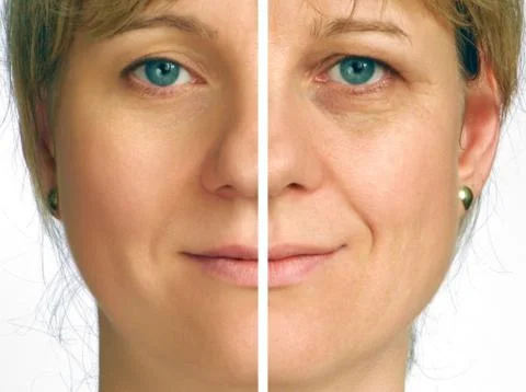 Correction of wrinkles on half of face Stock Photos