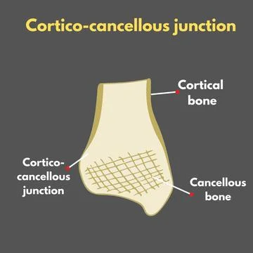 Cortico-cancellous junction Stock Illustration