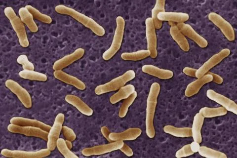 CORYNEBACTERIUM DIPHTHERIAE Viewed under scanning electron microscope (SEM... Stock Photos