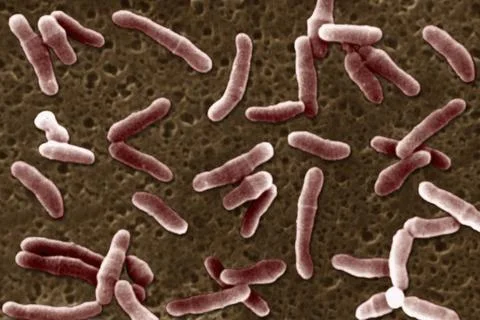 CORYNEBACTERIUM DIPHTHERIAE Viewed under scanning electron microscope (SEM... Stock Photos