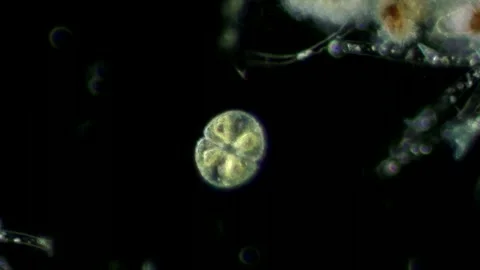 Cosmarium Botrytis Desmid at 20x Under Darkfield Microscopy Stock Footage 336944392