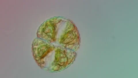 Cosmarium Desmid Close-Up at 50x Under Nomarski DIC Microscopy Stock Footage 336944397