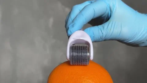 Cosmetic Derma Roller rolling over an orange – Skincare Concept. Dermaroller Stock Footage 303021771