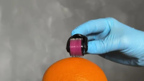 Cosmetic Derma Roller rolling over an orange – Skincare Concept. Dermaroller Stock Footage 303021917