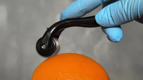 Cosmetic Derma Roller rolling over an orange – Skincare Concept. Dermaroller Stock Footage 303022008
