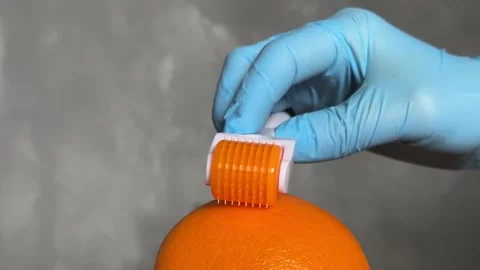 Cosmetic Derma Roller rolling over an orange – Skincare Concept. Dermaroller Stock Footage 303022051